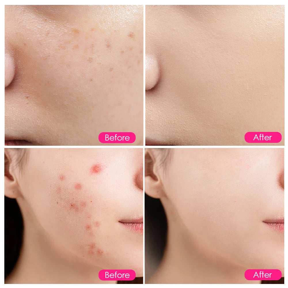 ✨ Lampe LED Anti-Âge Pro